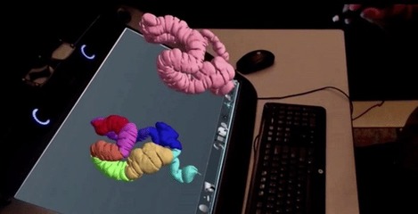 精准医疗新篇章 3D打印与虚拟现实融合开创外科手术新纪元